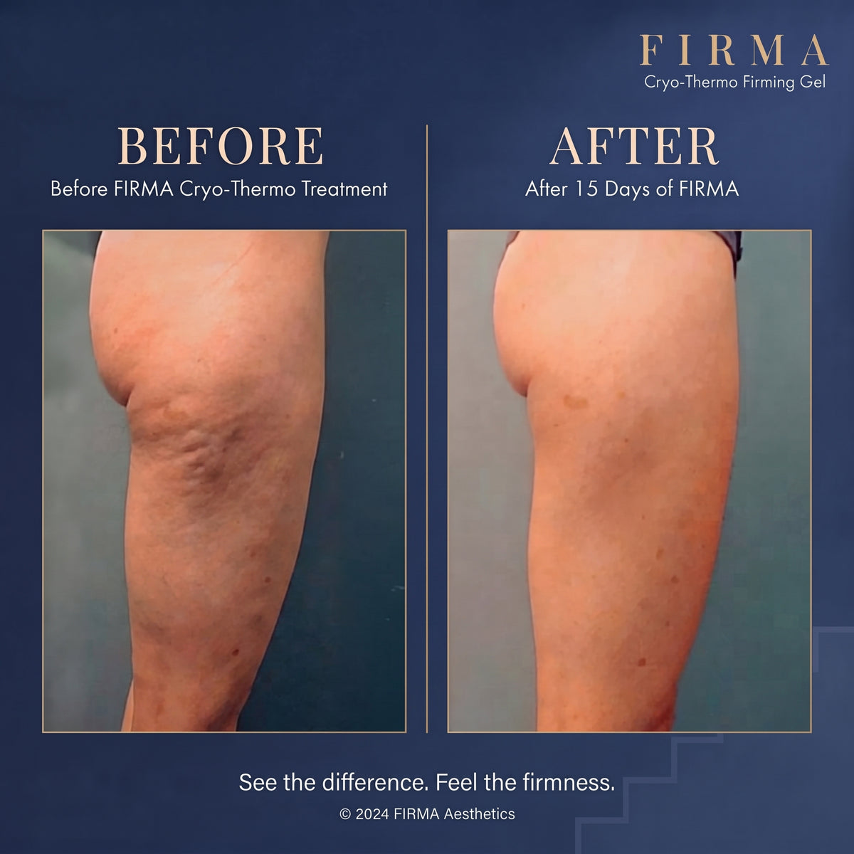 Firma Cryo-Thermo Gold Gel