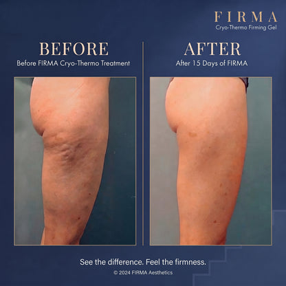 Firma Cryo-Thermo Gold Gel