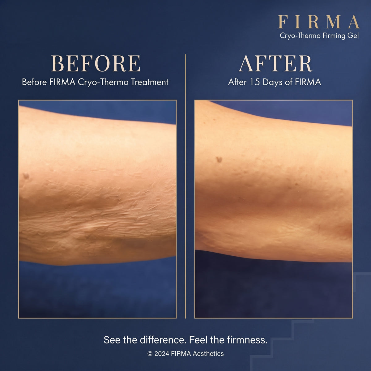 Firma Cryo-Thermo Gold Gel