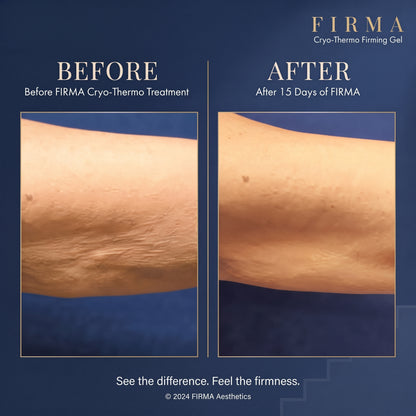 Firma Cryo-Thermo Gold Gel